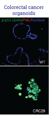 Colorectal cancer org